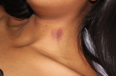 How To Give A Hickey - A Complete Guide